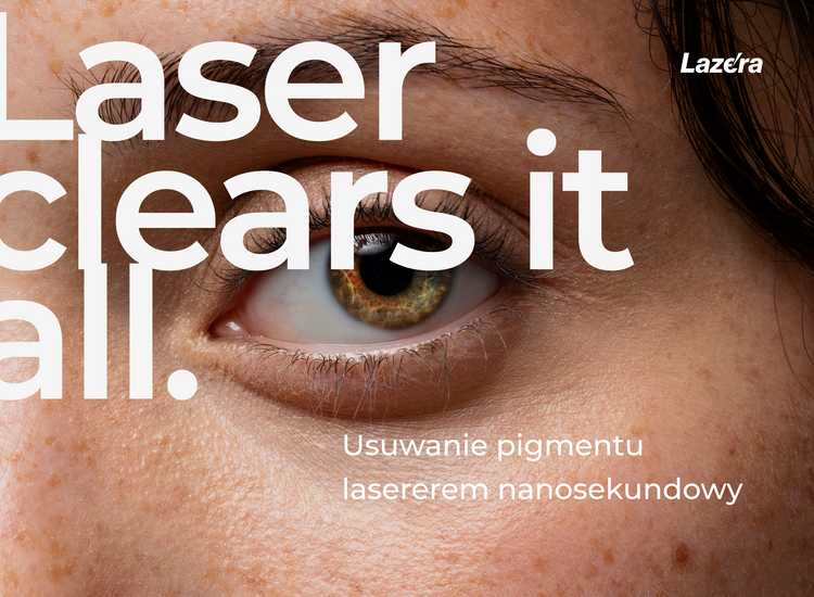 Usuwanie Pigmentu - Laser Nanosekundowy